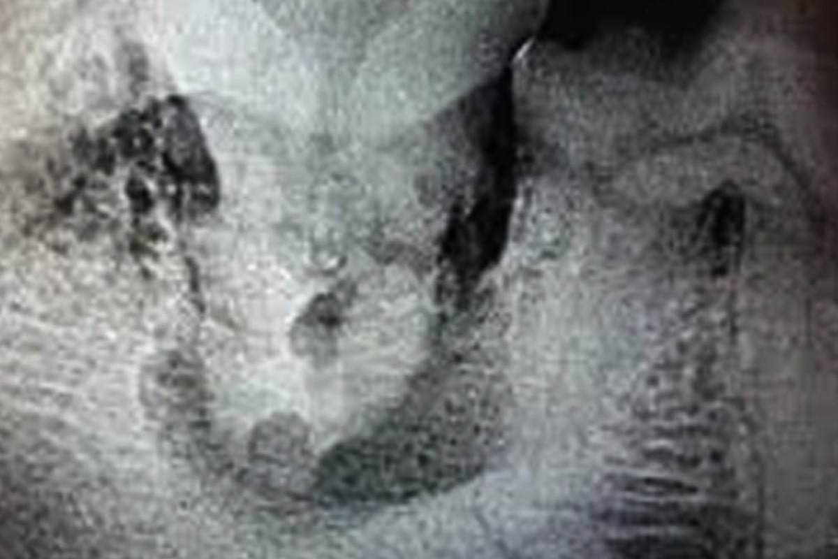 Cat-tooth